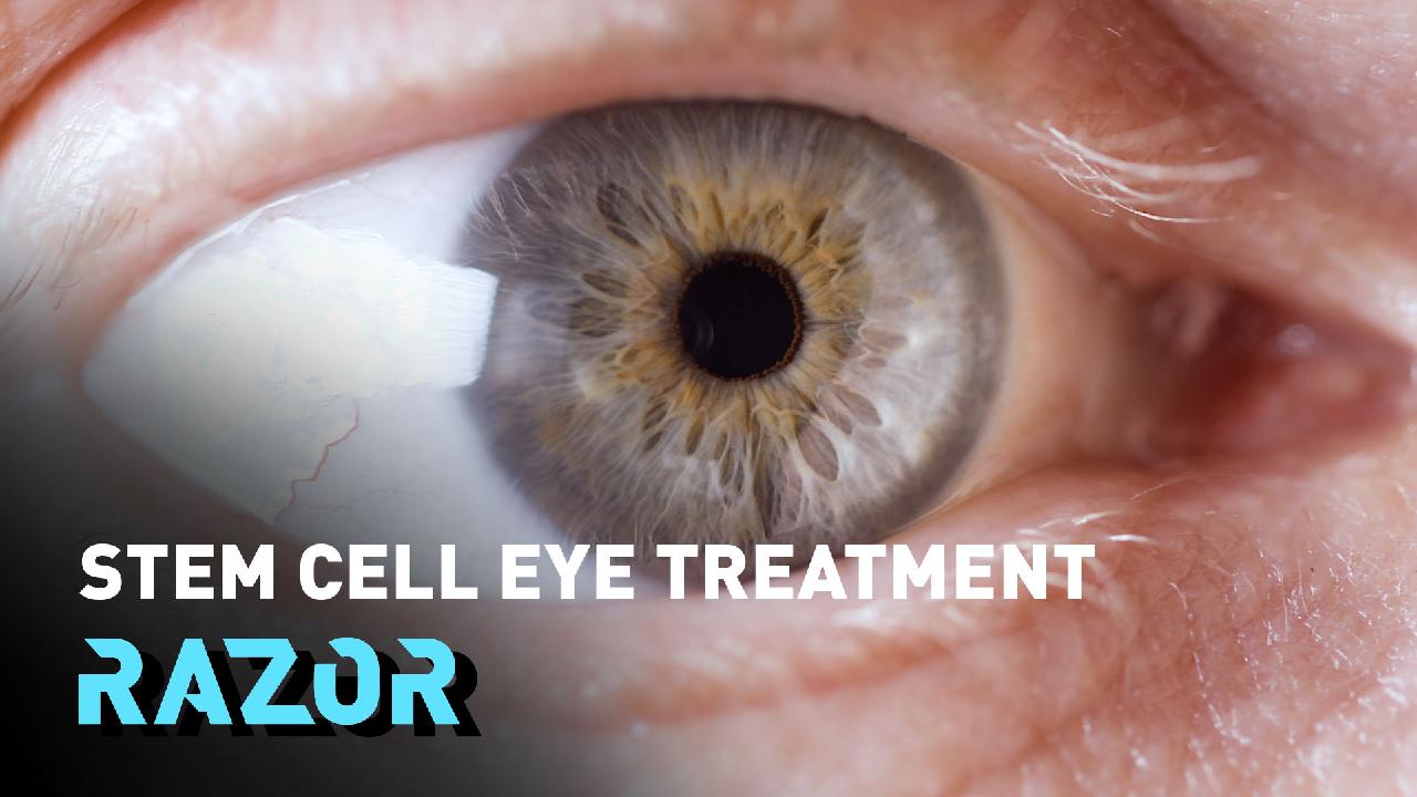 the-stem-cell-patches-that-are-rejuvenating-patients-eyesight-cgtn